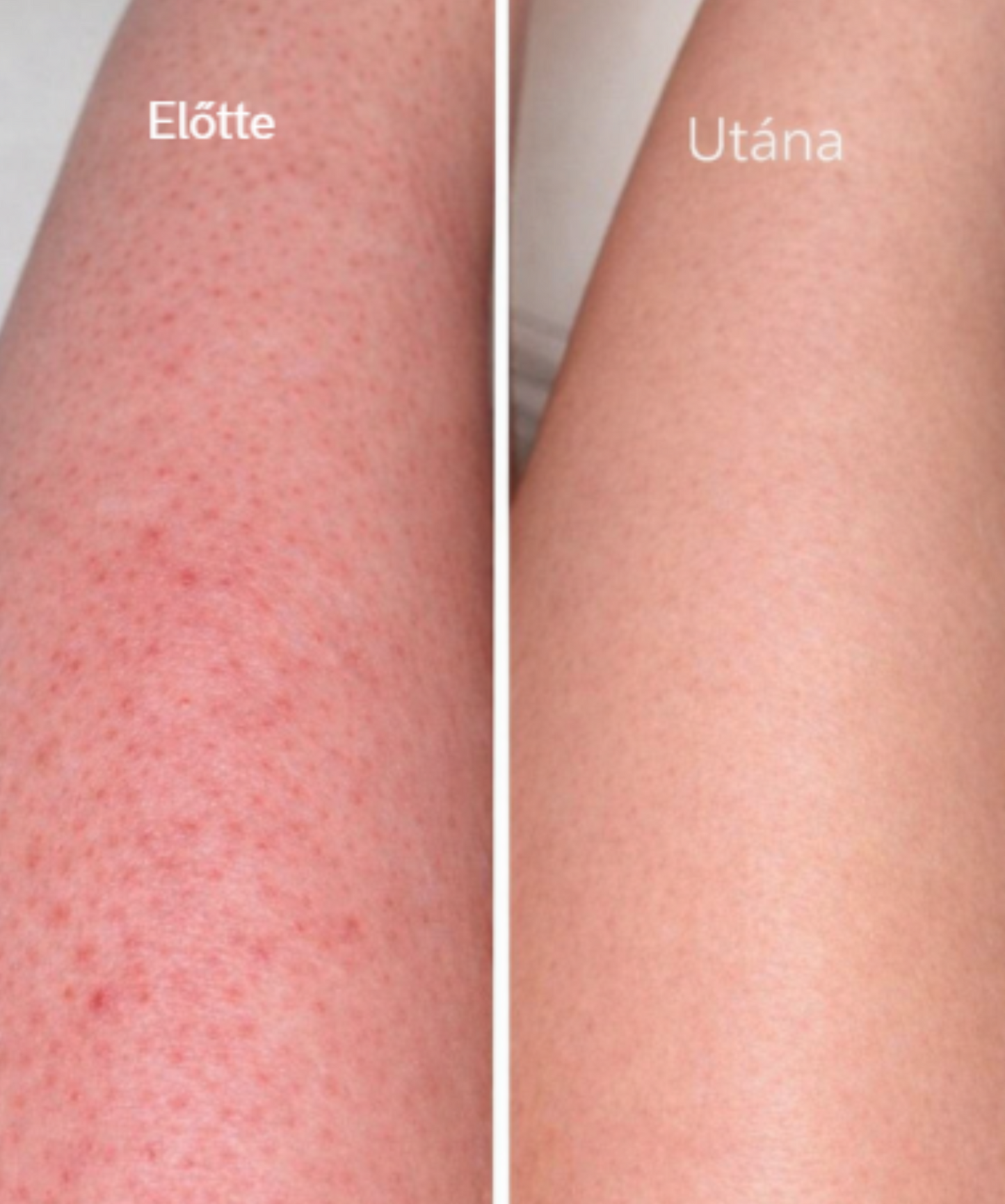 GlowUp Skin Glove
